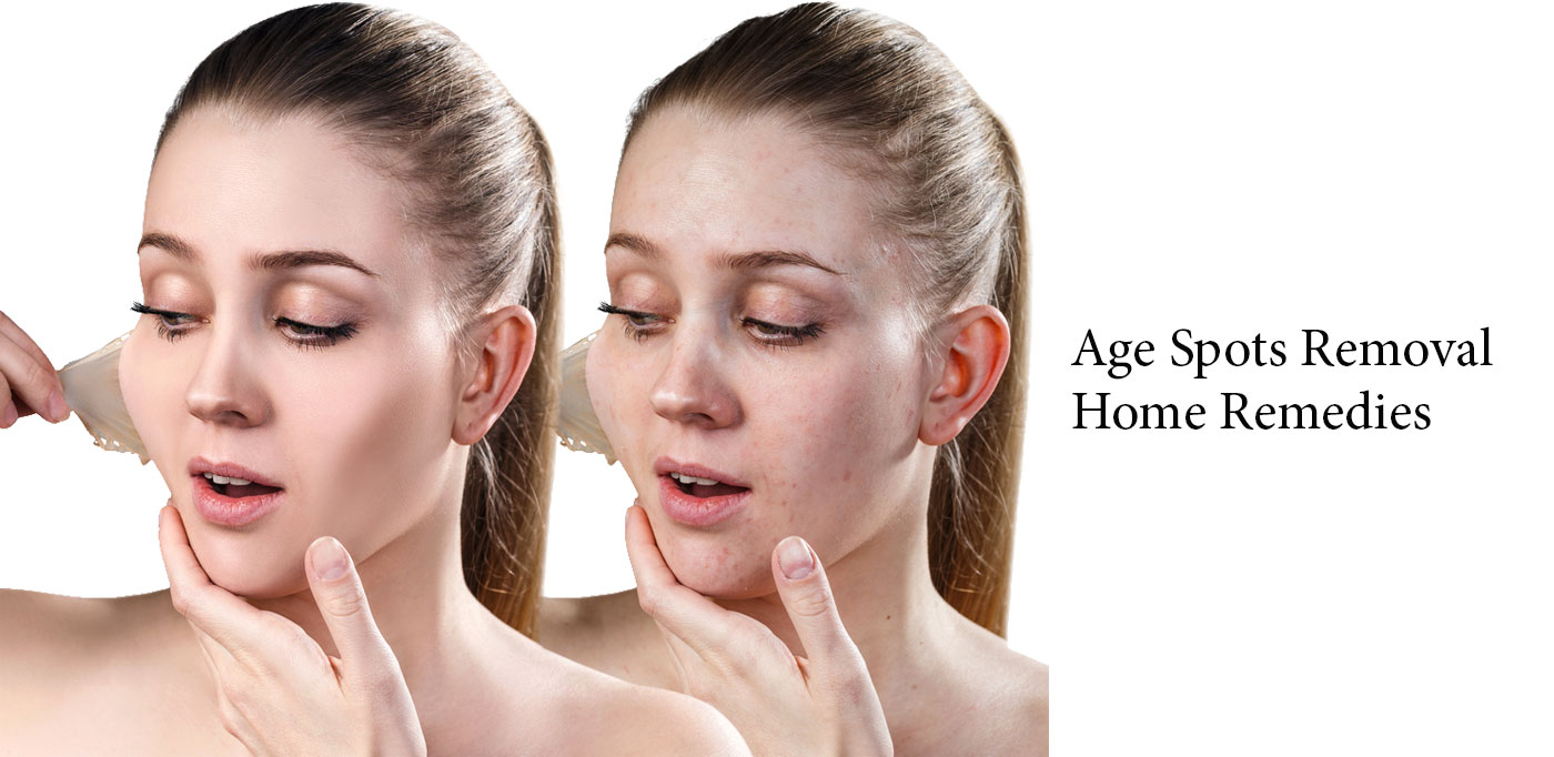 Age Spots Removal
