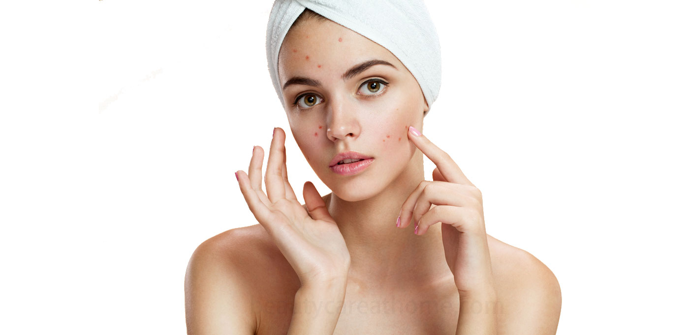how to eliminate acne